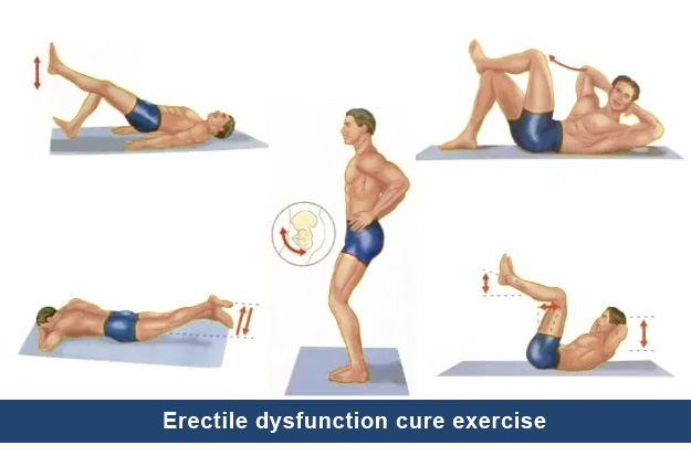 Can Exercise Reverse Erectile Dysfunction?