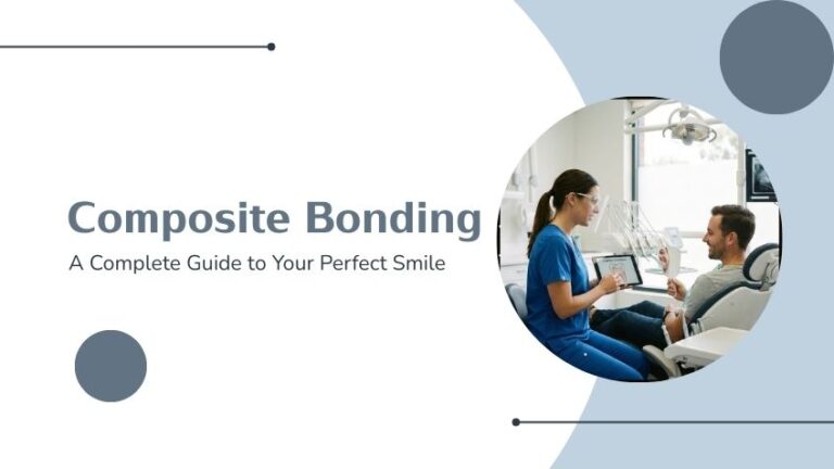 Composite Bonding in Battersea in London