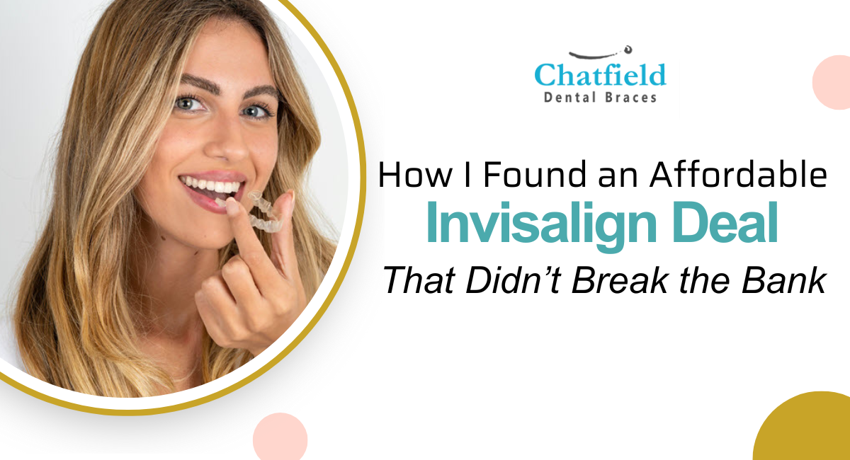 How I Found an Affordable Invisalign Deal That Didn’t Break the Bank