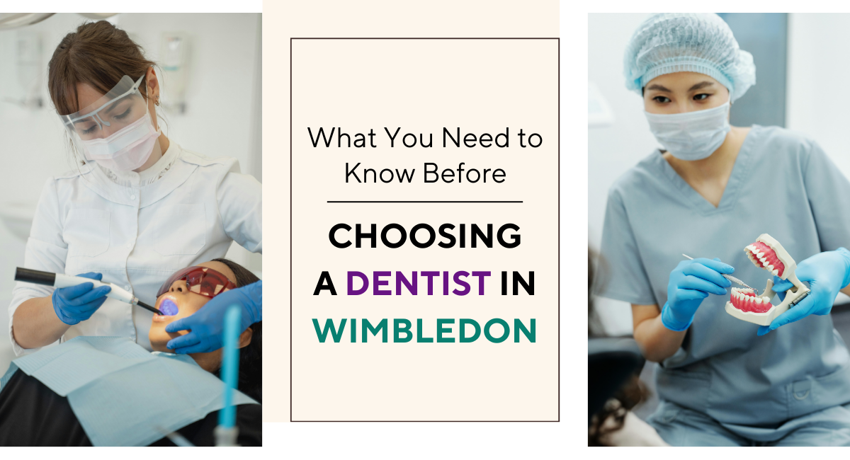 What You Need to Know Before Choosing a Dentist in Wimbledon